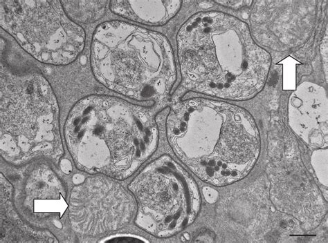  Mikrosporidium! En mikroskopisk parasit som kan infektera ett brett spektrum av värdorganismer