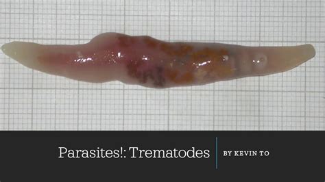  Trematoden Tetraphyllidea - En Parasit med Fyra Hjärtan som Lever i djupet!